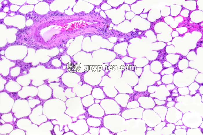 Poumon Homme sain x25 - gryphea.org